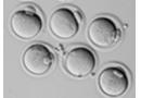卵子の発生能力を予測する細胞診断技術